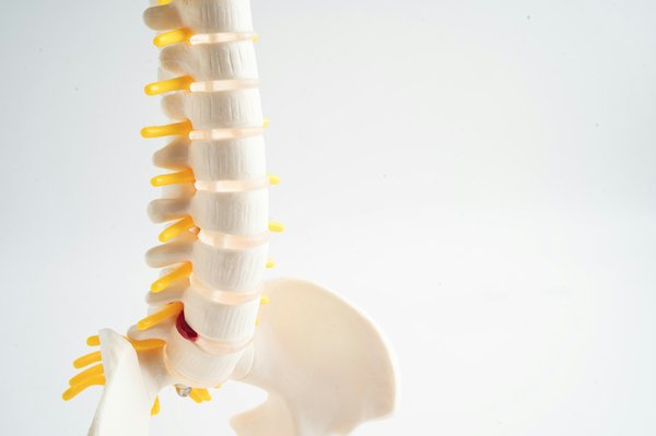 Comment reconnaître et traiter une hernie discale efficacement ?